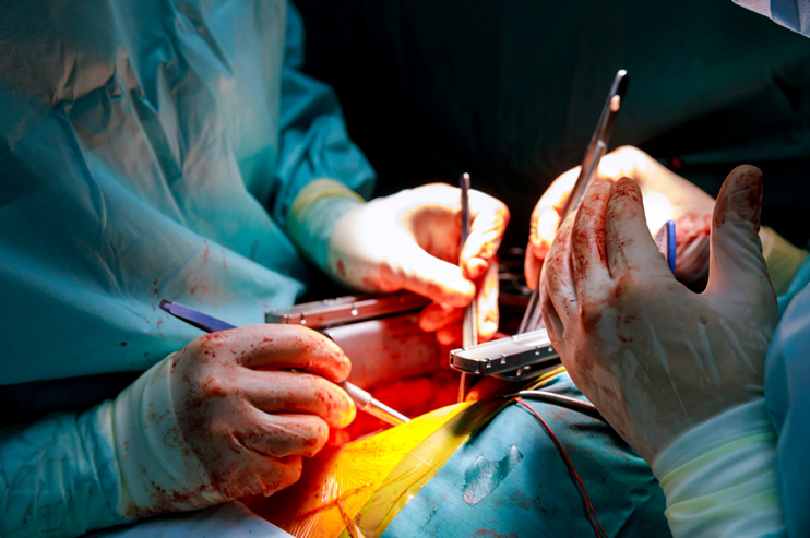 Surgical Aortic Valve Replacement: What You Need to Know